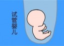 培养南昌捐卵宝宝艺术细胞的小技巧
